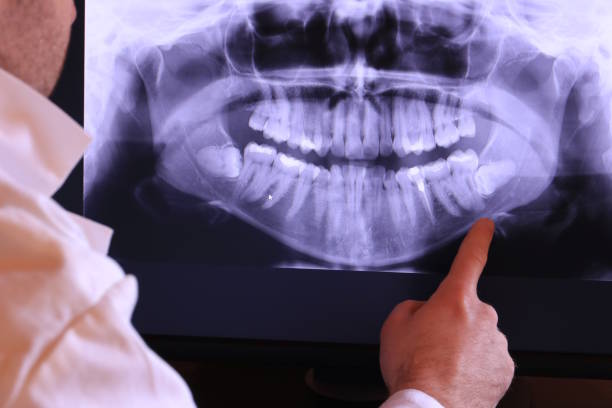 Best Pediatric Emergency Dentist in Keller, TX
