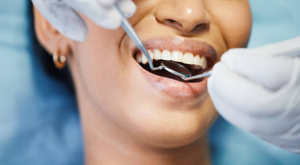 Best Emergency Dental Extractions in Keller, TX